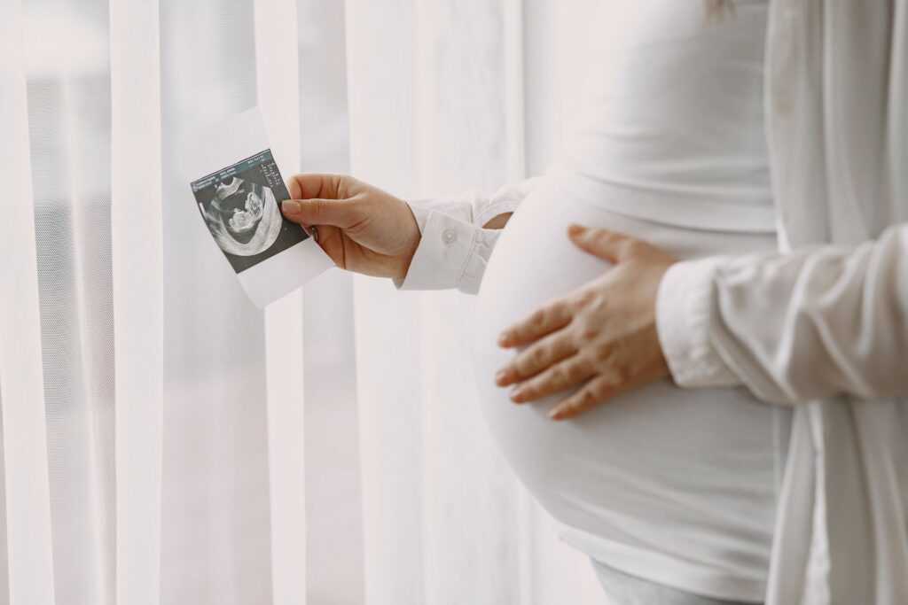 Doc. Toporcerová: šance na otehotnenie klesajú s vekom, páry s neplodnosťou prichádzajú neskoro 4 pregnant woman standing by window looking photo