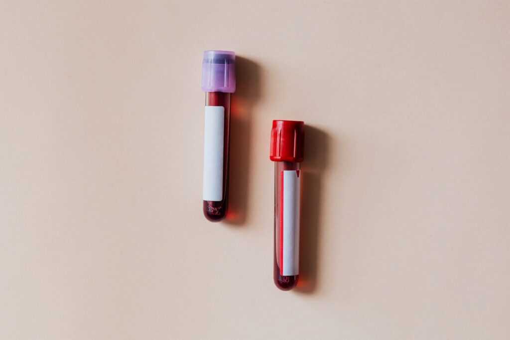 blood test tubes beige surface
