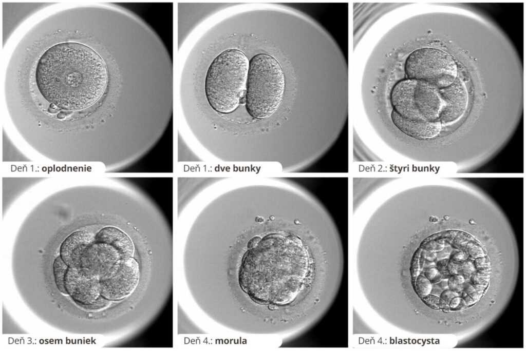 Vývoj embrya po IVF: čo sa deje počas prvých 6 dní? 1 embryo vyvoj